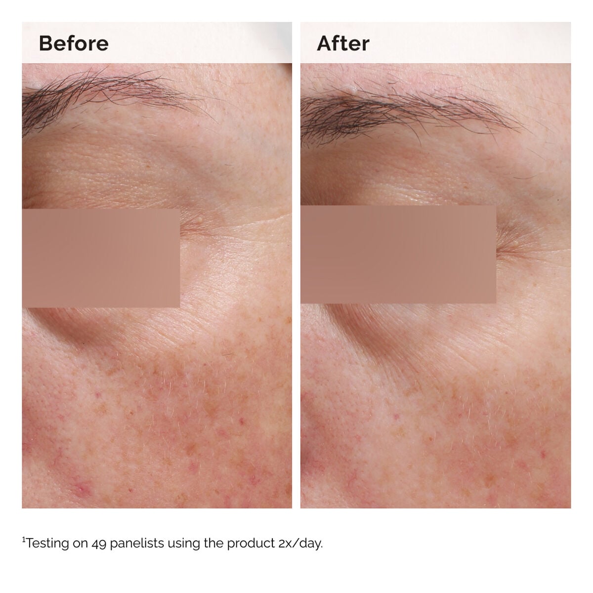 niacinamide-5-face-and-body-emulsion-n8 2024-08-23-ORD-Nia-5pct-Face-Body-B-A-Elasticity-Global-02-1x1.jpg