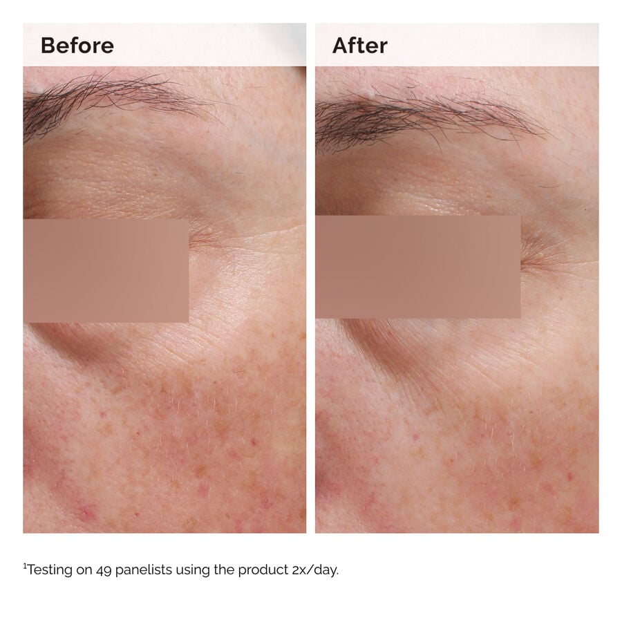niacinamide-5-face-and-body-emulsion-n8 2024-08-23-ORD-Nia-5pct-Face-Body-B-A-Elasticity-Global-02-1x1.jpg
