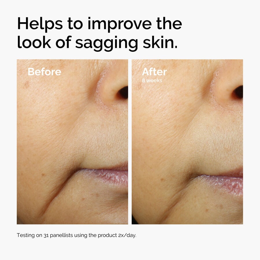 caffeine-3-escin-1-face-serum-o6 ord-caffeine-3pct-escin-1pct-face-serum-before-after-sagging.jpg