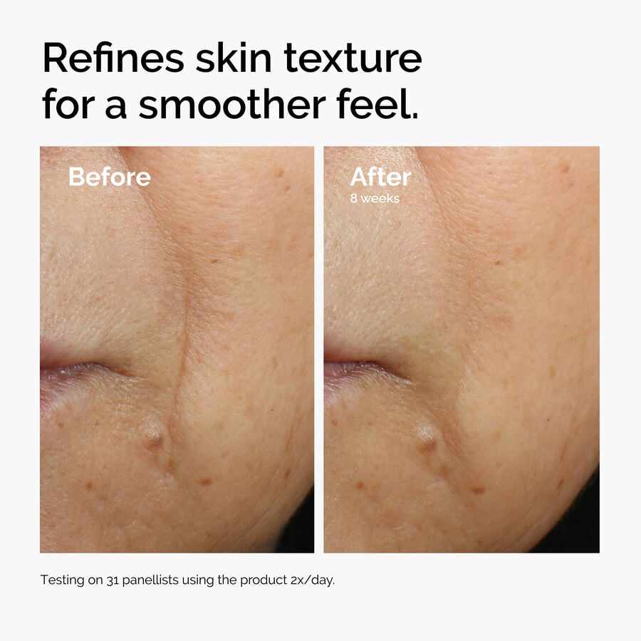 caffeine-3-escin-1-face-serum-o6 ord-caffeine-3pct-escin-1pct-face-serum-before-after-texture.jpg