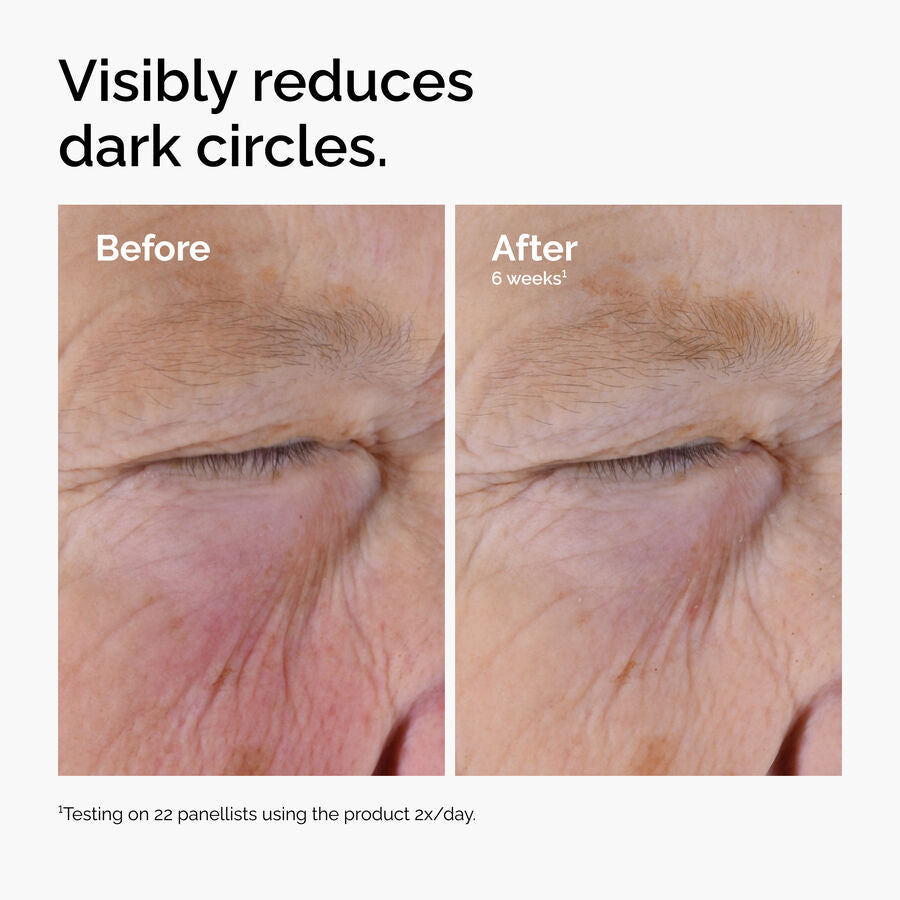 caffeine-solution-5-egcg-eye-serum-g8 ord-caffeine-solution-egcg-dark-circles-before-after.jpg