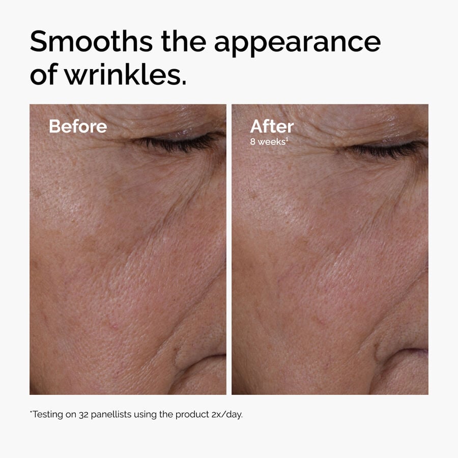 multi-peptide-ha-serum-g1 ord-multi-peptide-ha-serum-wrinkles-before-after.jpg