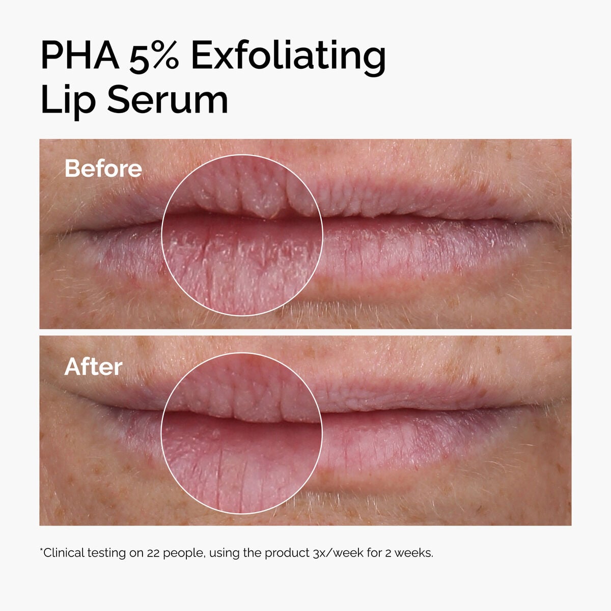 pha-5-exfoliating-lip-serum-l6 ord-pha-5pct-lip-exfoliating-serum-before-after.jpg