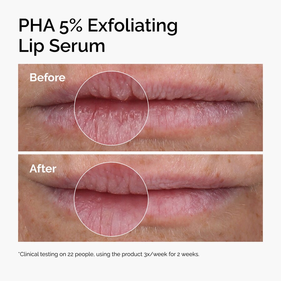 pha-5-exfoliating-lip-serum-l6 ord-pha-5pct-lip-exfoliating-serum-before-after.jpg