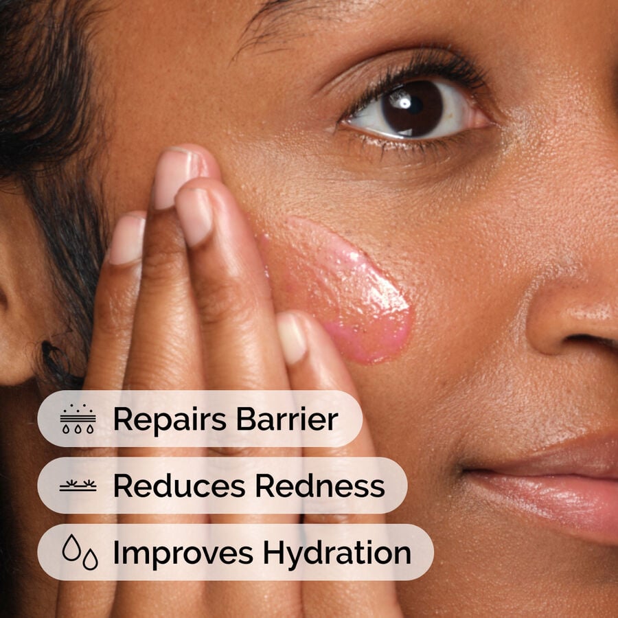 soothing-and-barrier-support-serum-set-u7 ord-soothing-barrier-support-serum-model-application-with-benefits.jpg